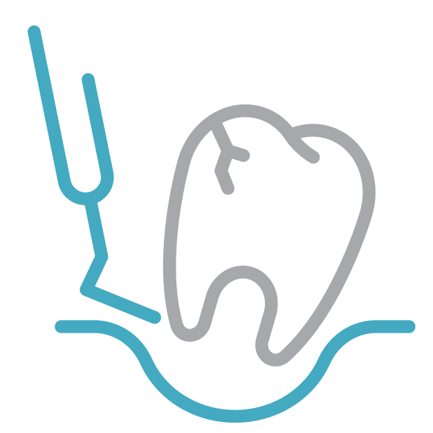 Apicoectomy (Root-End Surgery) icon