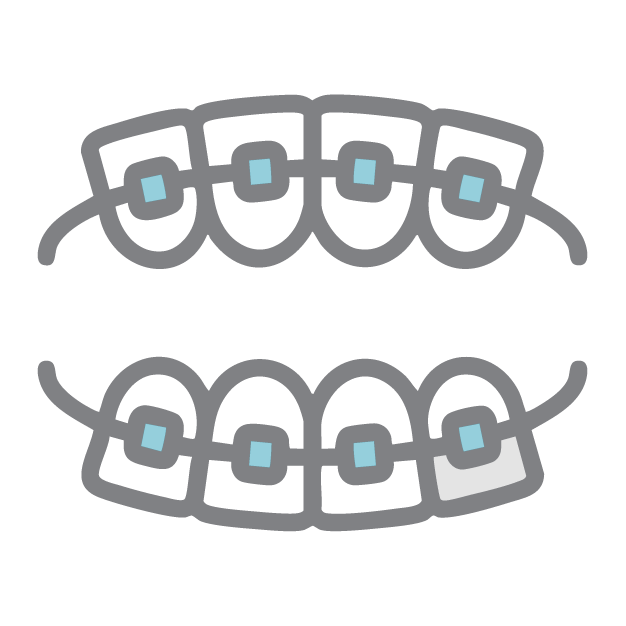 Traditional Braces icon